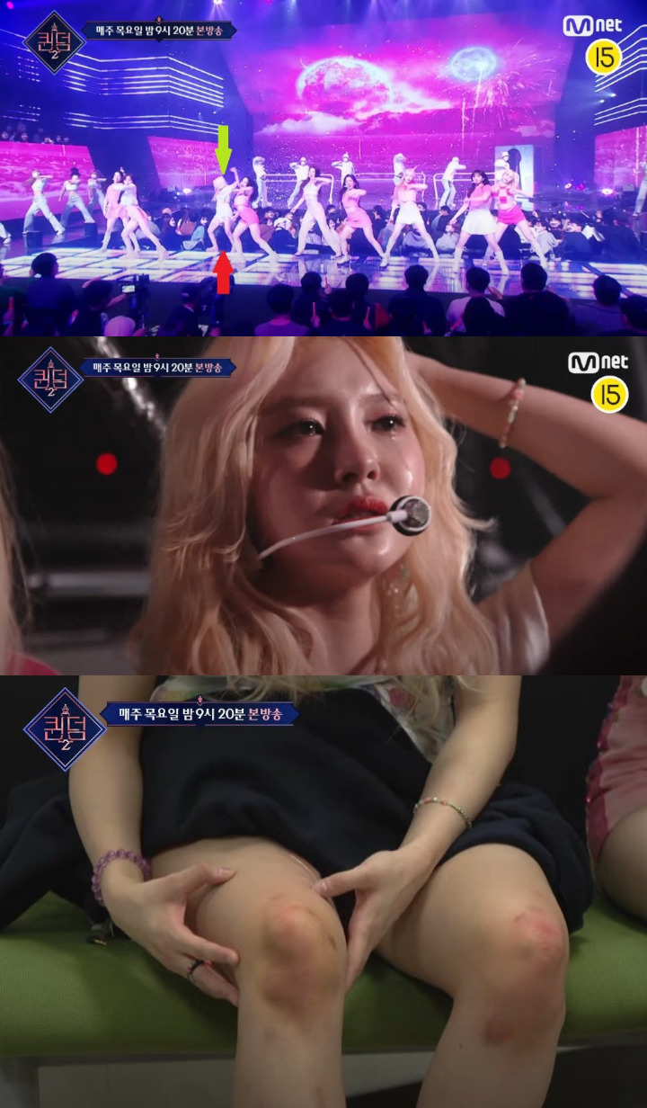 Kim Dayeon Kep1er Alami Insiden di Panggung \'Queendom 2\', Cedera Parah?