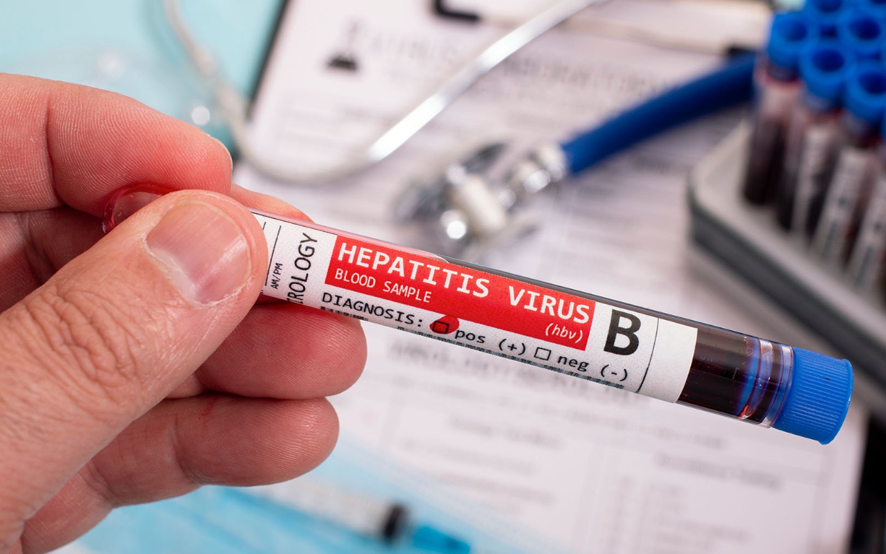 Kasus Hepatitis Akut Misterius Bisa Serang Orang Dewasa? Ini Kata IDAI dan Kemenkes