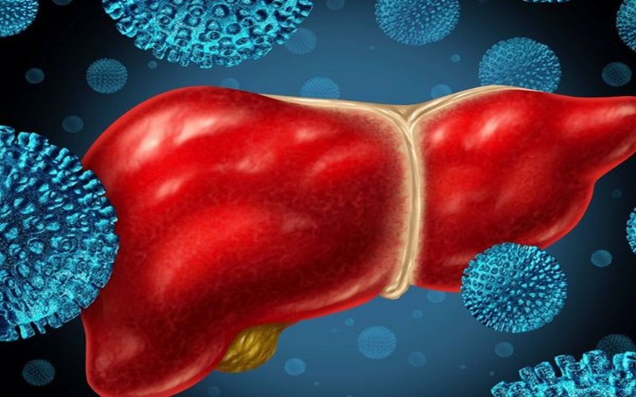 Indonesia Deteksi 15 Kasus Suspek Hepatitis Akut Misterius, Kenali Gejala dan Cara Pencegahannya!