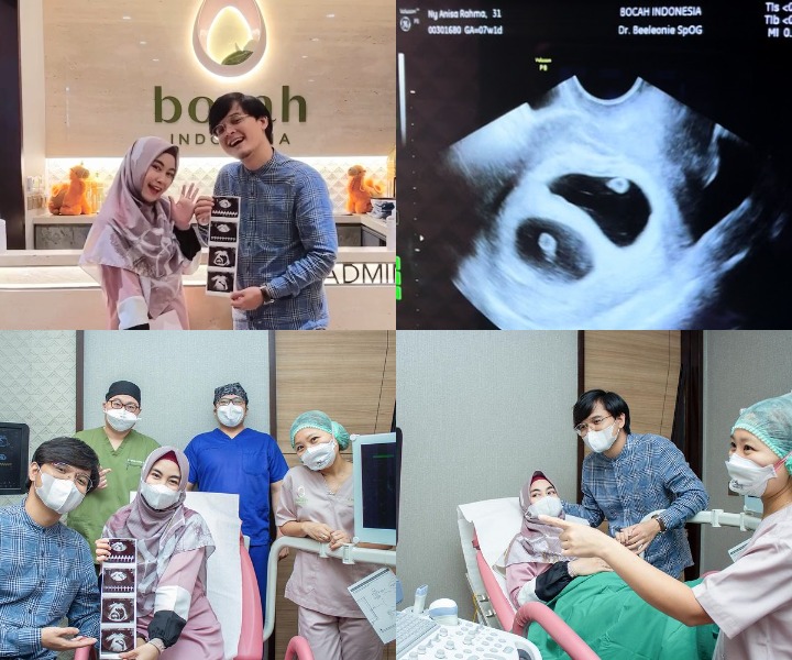 Momen bahagia tunjukkan hasil USG