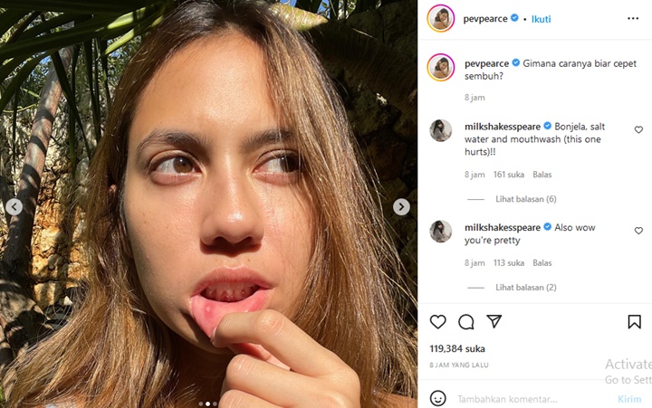 Pevita Pearce Keluhkan Sariawan Tak Kunjung Sembuh Hampir 2 Minggu, Terpaksa Lakukan Ini