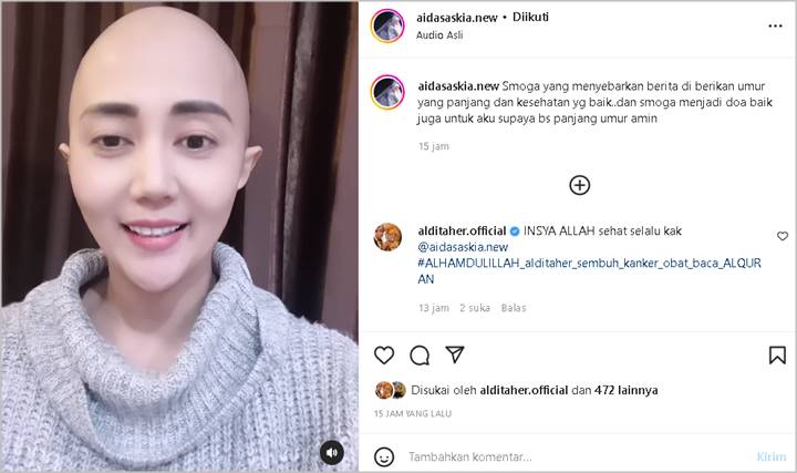 Aida Saskia Diterpa Hoaks Meninggal Dunia, Reaksinya Banjir Suntikan Semangat