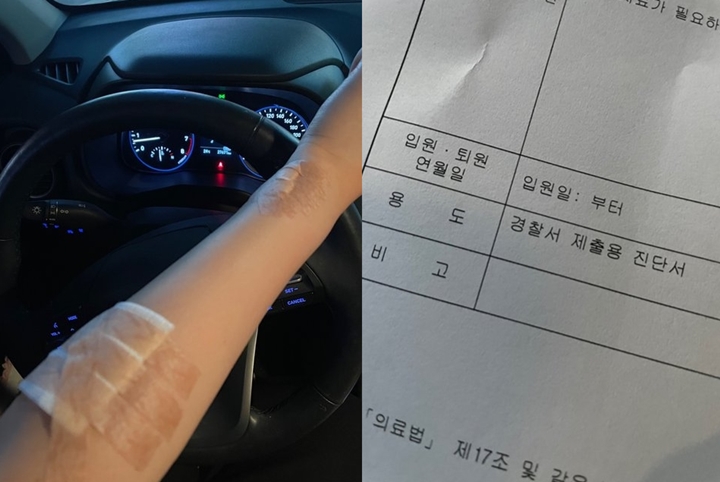 Warga Curhat Dianiaya Diduga Oleh Staf di Lokasi Syuting Drama TV Chosun
