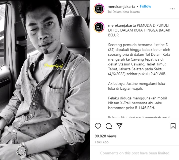 Adik Verlita Evelyn Luka Parah Usai Dikeroyok Membabi Buta, Terkuak Motif Tersangka