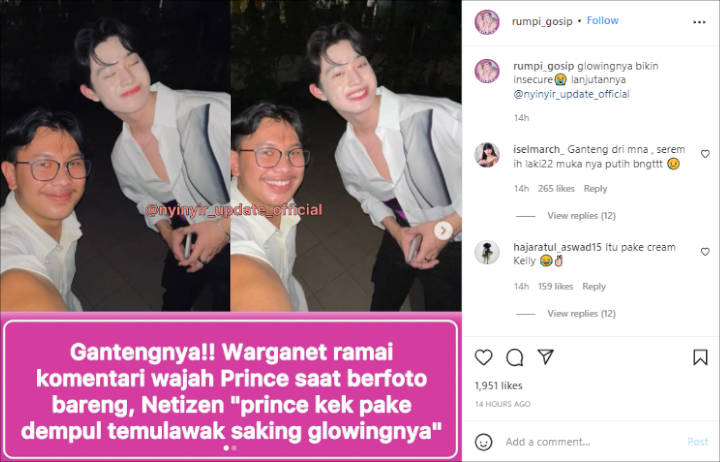 Kulit Wajah Gabriel Prince Putih Kebangetan Hingga Terlihat Belang, Banjir Tawa Sinis?