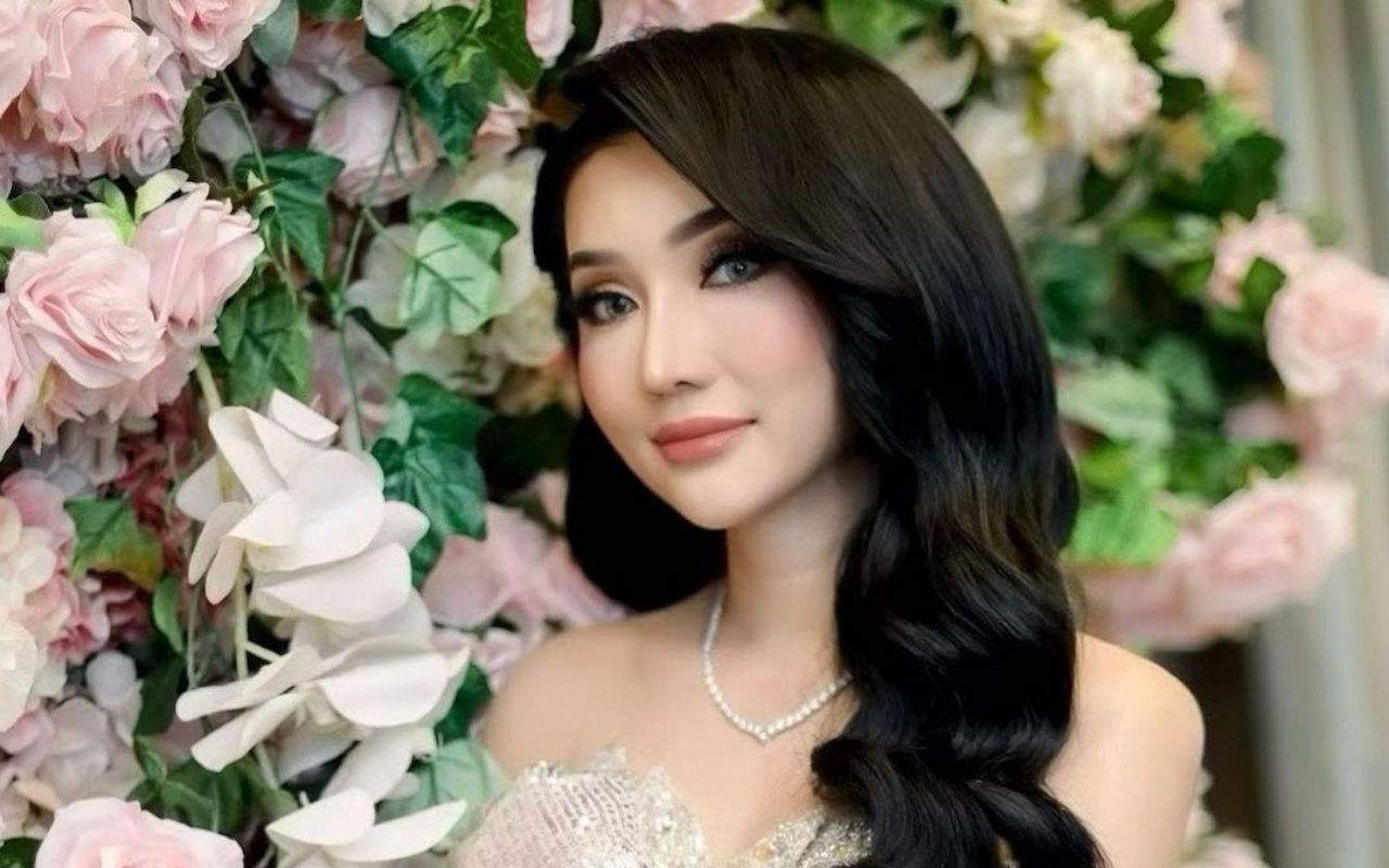 Lucinta Luna Pamer Foto Diperban Diduga Oplas Lagi, Penampakan Bibir Berdarah Bikin Ngeri