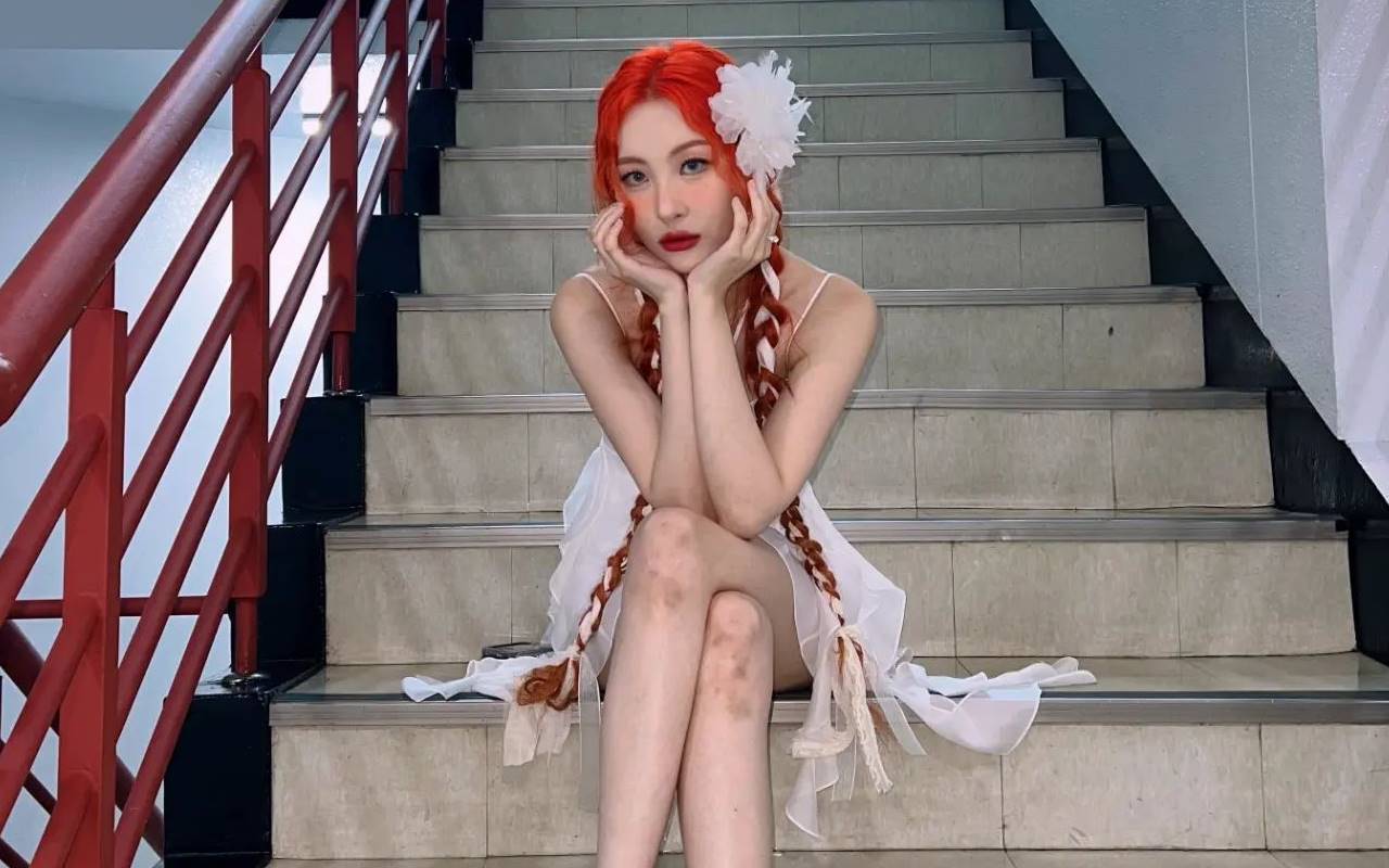 Sunmi Tak Masalah Lakukan Adegan Ciuman di MV 'Heart Burn' Berkat Faktor Usia