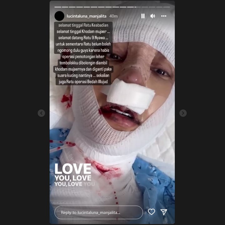 Lucinta Luna Akui Lakukan Operasi Pemotongan Leher dan Wajah, Demi Secantik Jang Won Young IVE?
