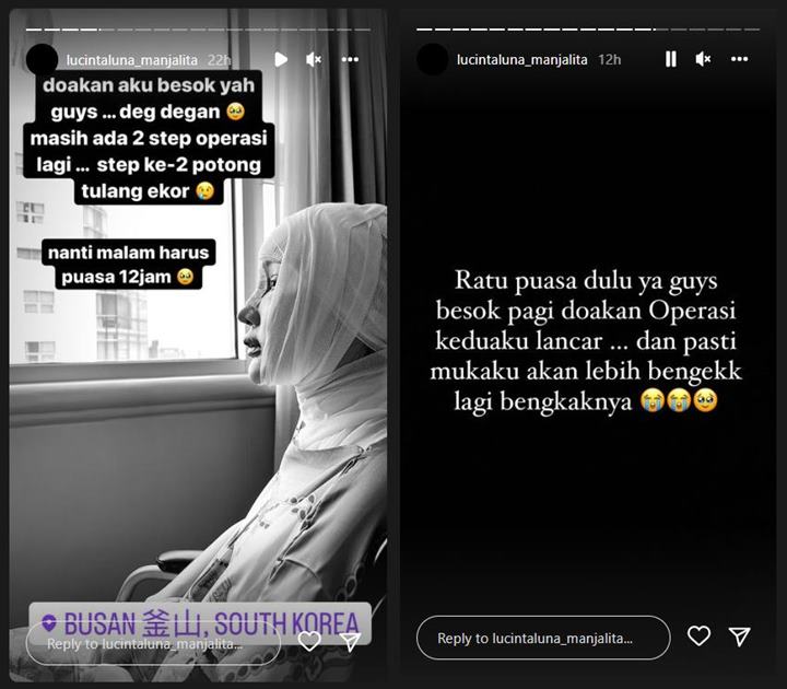 Kepala Masih Dililit Perban, Lucinta Luna Minta Doa Jelang Operasi Lagi Bagian Ini: Deg-degan