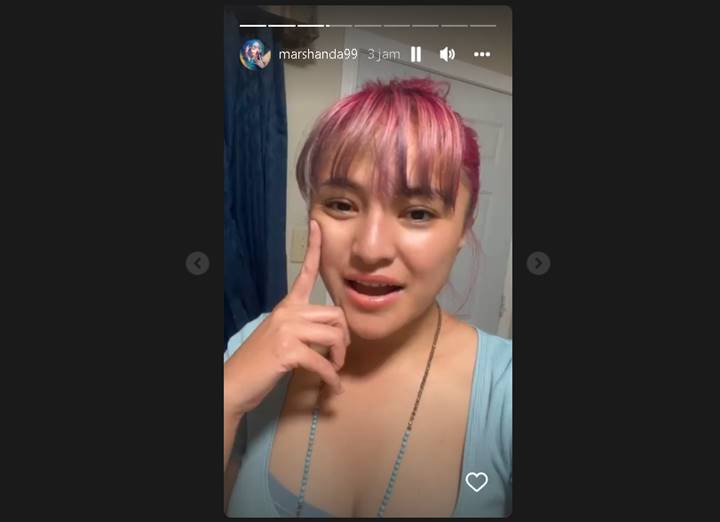 Muncul Lagi, Marshanda Singgung Kondisi Terbaru Hingga ‘Sentil’ Sosok yang Pura-pura Paling Tahu
