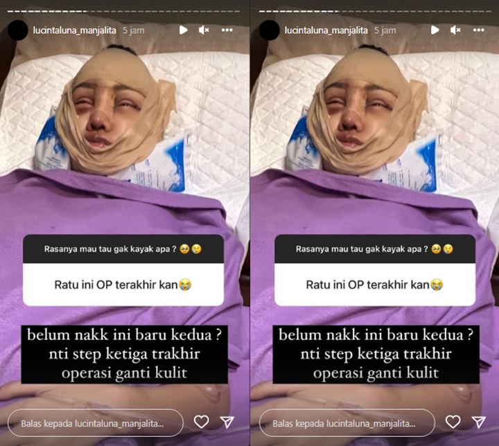 Bantah yang Terakhir, Lucinta Luna Ungkap Rencana Bakal Operasi Ganti Kulit