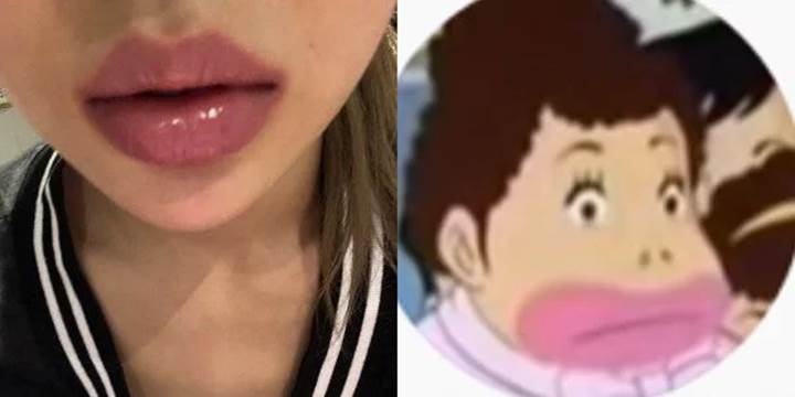 Dituduh Rasis, Yves LOONA Minta Maaf Pasca Pasang Foto Kartun Korea Punya Bibir Tebal