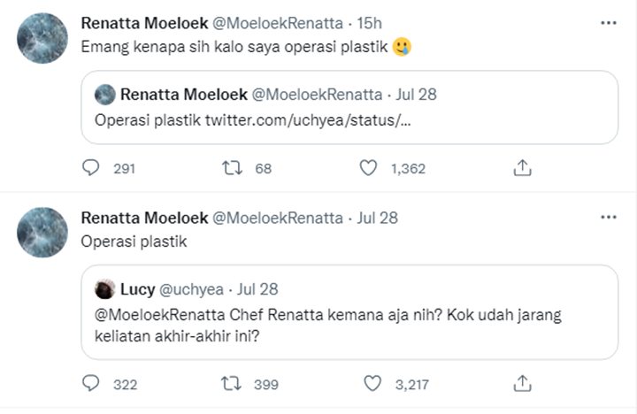 Ditanya Soal Kabarnya, Renatta Moeloek Malah Bikin Heboh Usai Ngaku Operasi Plastik