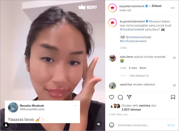 Chef Renatta Pamer Bentuk Bibir Baru Seraya Pose Centil Usai \'Akui\' Oplas, Fans Auto Ngakak