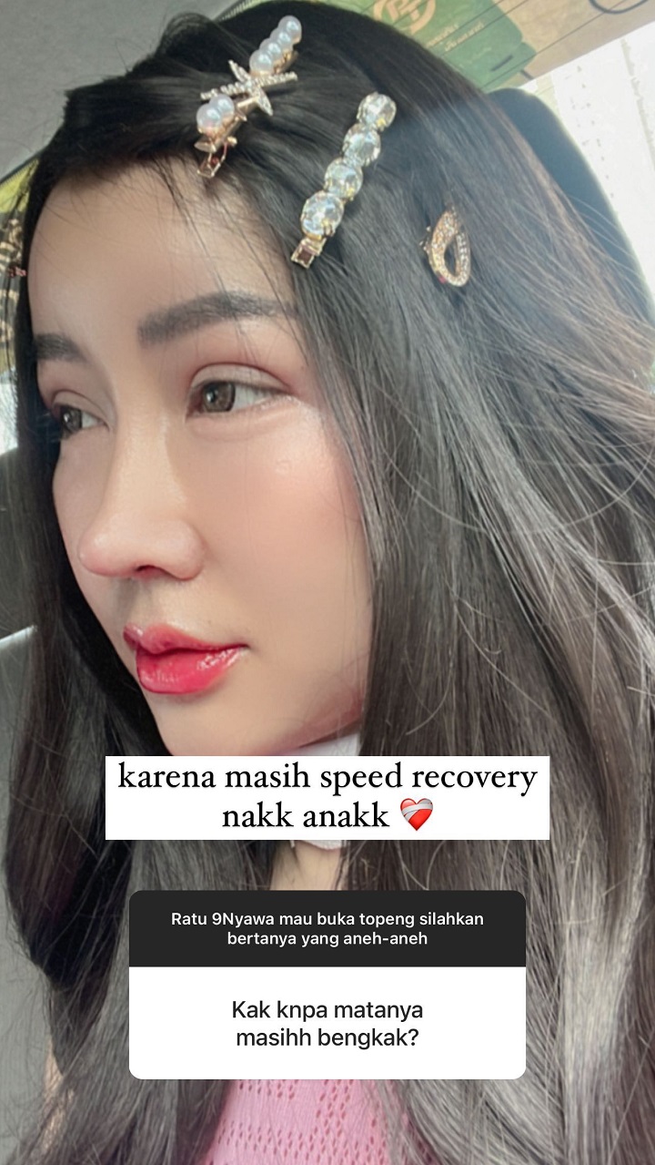 Wajah Masih Bengkak