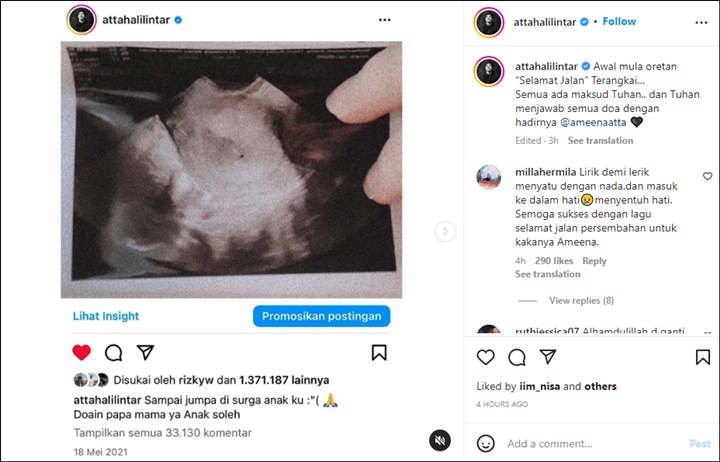 Atta Halilintar Flashback Saat Kehilangan Kakak Baby Ameena, Seraya Posting Video Ini