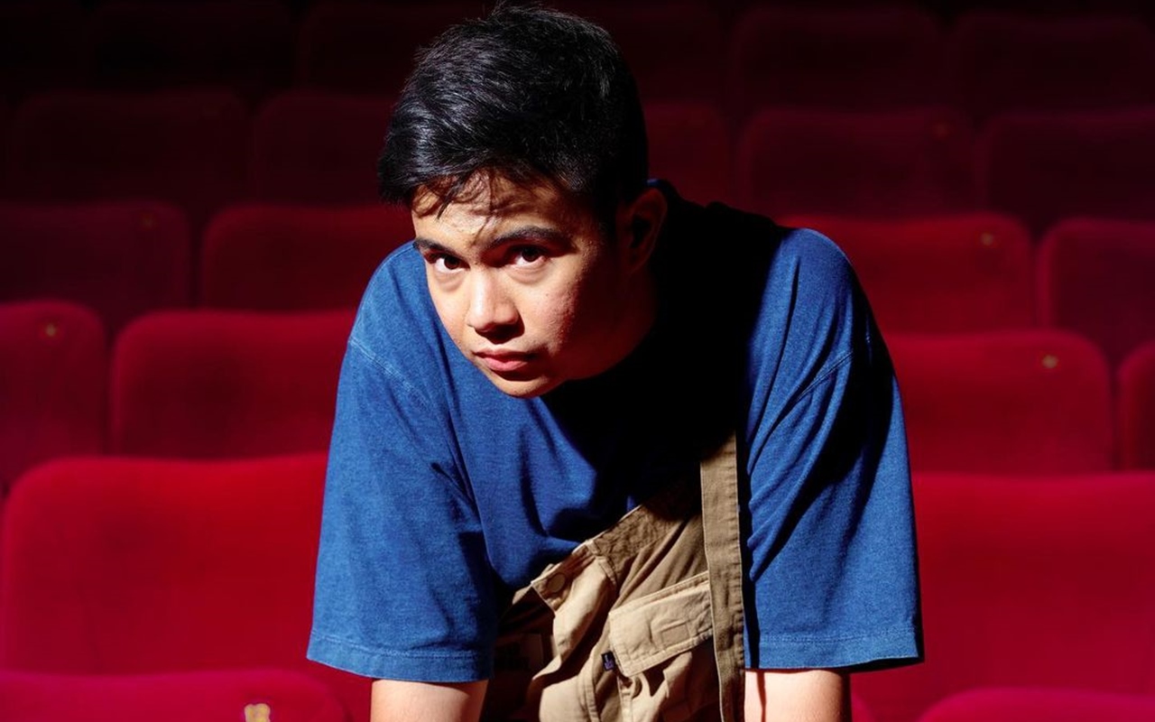 Umay Shahab Tunjukkan 'Komuk' Penuh Jerawat Saat Masih Syuting 'Mencuri Raden Saleh', Tegaskan Ini