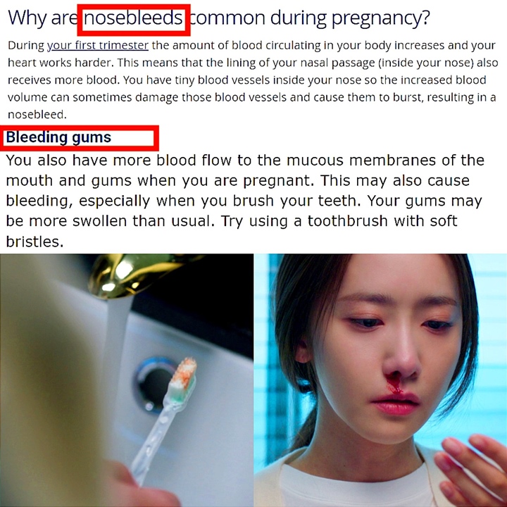 Bukan Leukimia, Muncul Teori Alasan Lain Yoona SNSD Mimisan di \'Big Mouth\'