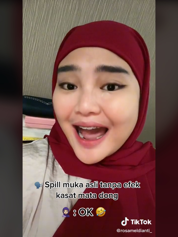 Selalu Kinclong, Rosa Meldianti Spill Muka Tanpa Filter Dinilai Berbeda?