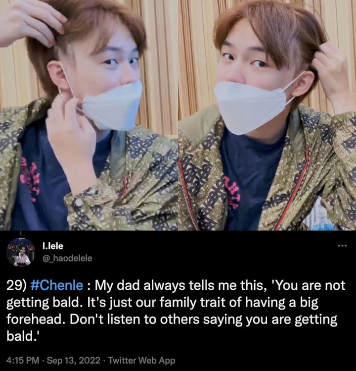 Tak Peduli Imej, Chenle NCT Dream Blak-blakan Bahas Kebotakan Saat Siaran Live