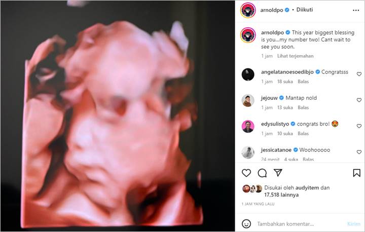 Selamat! Chef Arnold Kabarkan Istri Hamil Anak Kedua, Janjikan Hadiah untuk yang Bisa Tebak Soal Ini
