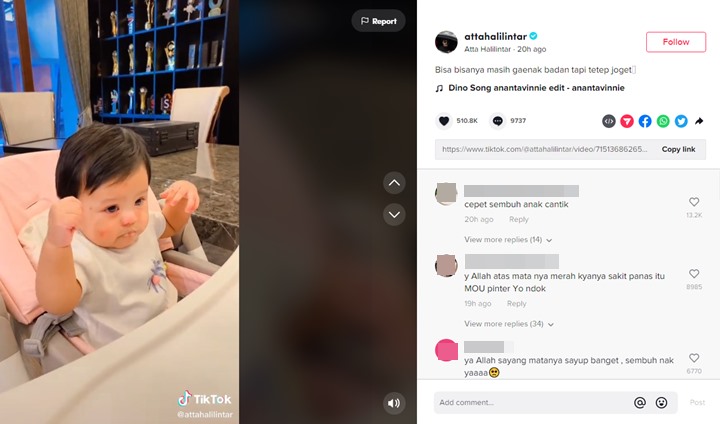 Atta Ungkap Ameena Masih Tetap Joget Meski Sakit, Wajah Pucat Bikin Nyesek
