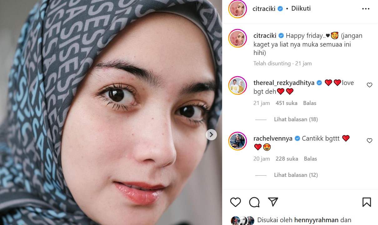 Citra Kirana PD Pamer Foto Close Up, Wajah Natural Bikin Tak Percaya