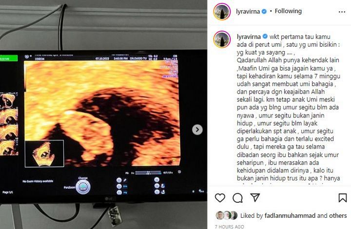 Jantung Janin Lyra Virna Tak Berdetak