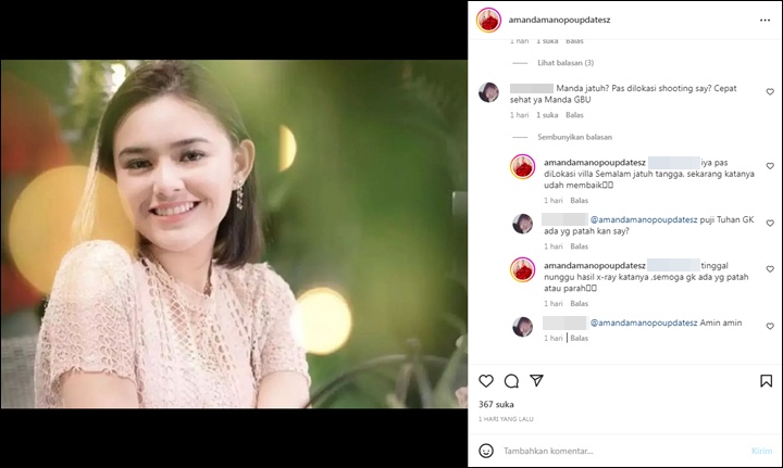 Baru Sembuh, Amanda Manopo Kini Dikabarkan Kecelakaan di Lokasi Syuting