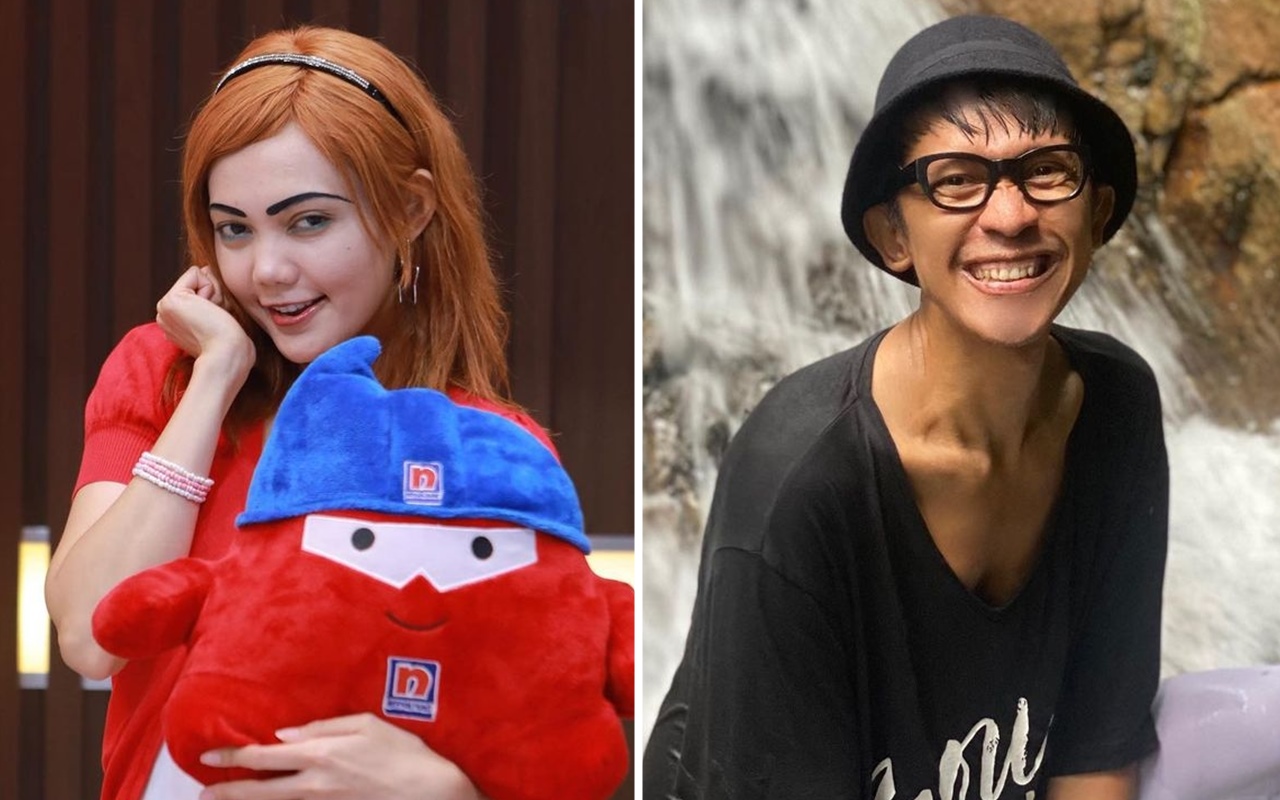 Rina Nose 'Nyamar' Jadi Agnez Mo Bikin Aming Kaget: Sumpah!