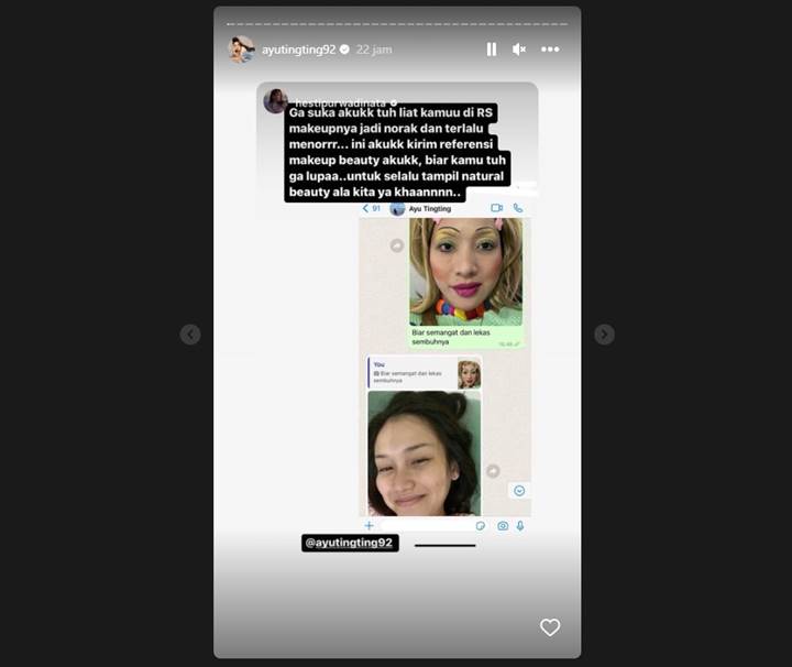 Ayu Ting Ting Masuk RS, Hesti Purwadinata Beri Suntikan Semangat dengan Cara Kocak