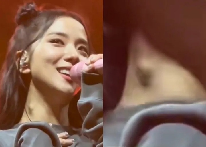 Jisoo Punya Benjolan di Leher Saat Konser BLACKPINK Bikin Khawatir