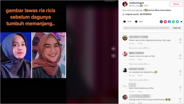 Ria Ricis Cueki Isu Operasi Plastik Gegara Dagu Lancip, Ungkit Jasa ...