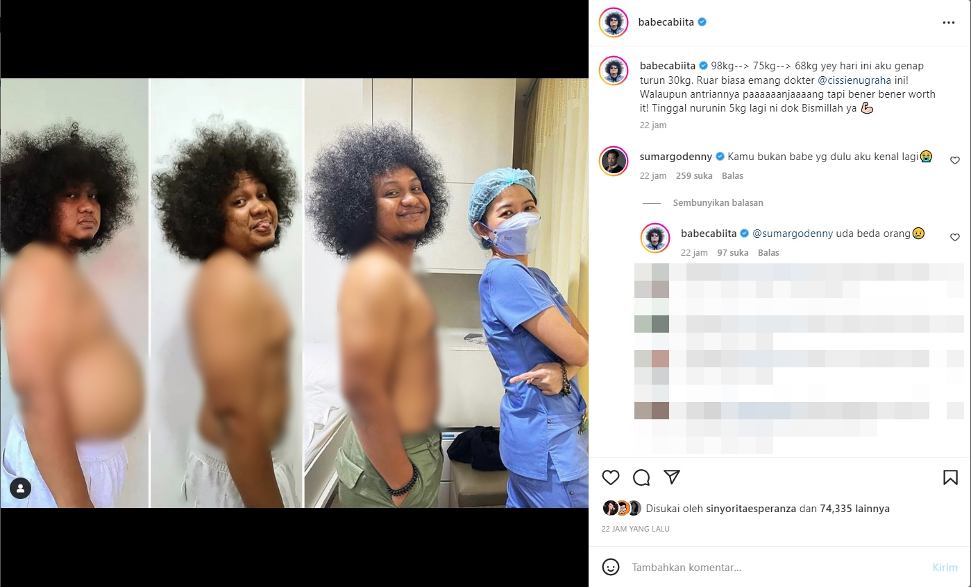 Denny Sumargo Sedih Lihat Perubahan Tubuh Babe Cabita