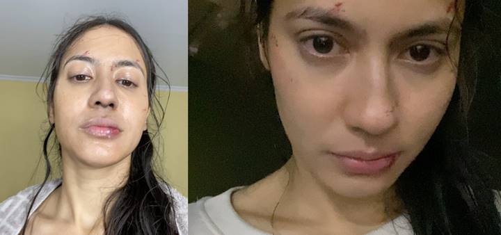 Muka Sampai Babak Belur