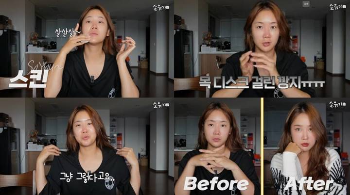 Soyou Eks Sistar Kini Makin Gemuk Akibat Efek Steroid