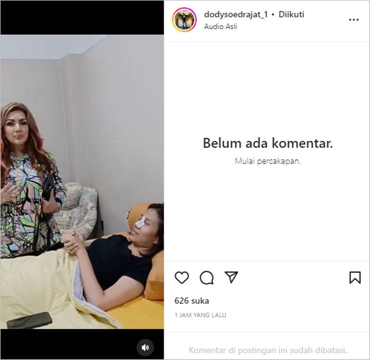 Doddy Sudrajat Sebut Hidung Mayang Lucyana Fitri Sudah Mulai Berubah Usai Jalani Operasi