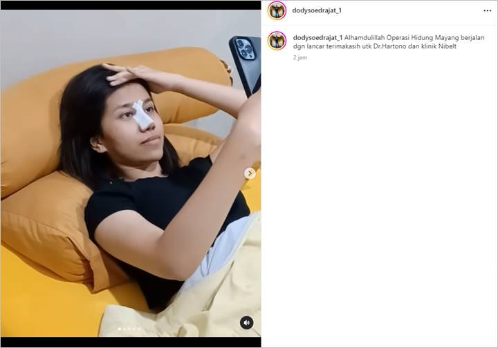 Doddy Sudrajat Sebut Hidung Mayang Lucyana Fitri Sudah Mulai Berubah Usai Jalani Operasi