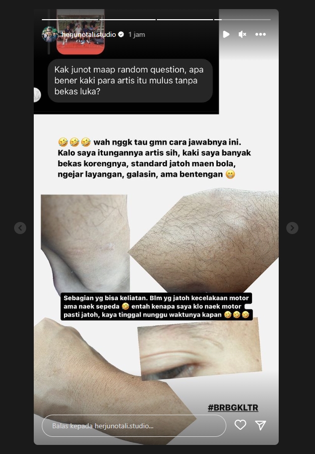 Herjunot Ali Bantah Label Semua Artis Punya Kulit Mulus