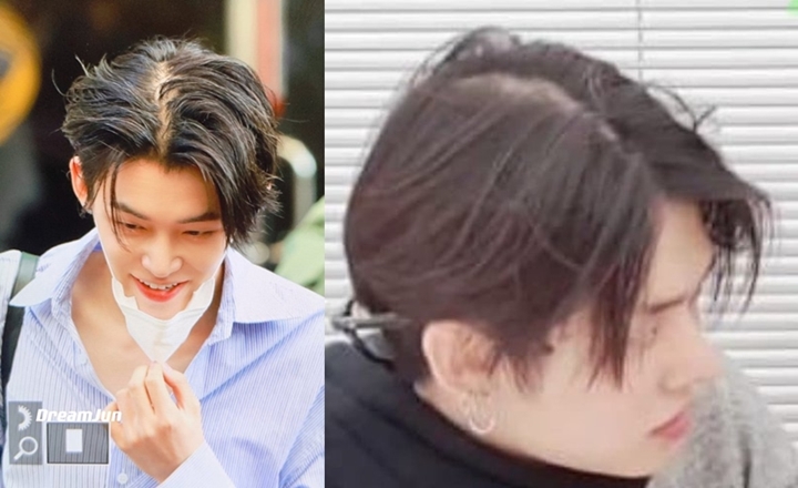 Yeonjun TXT Diduga Mulai Alami Kebotakan Tuai Kekhawatiran Fans