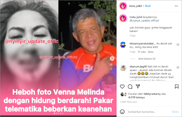 Venna