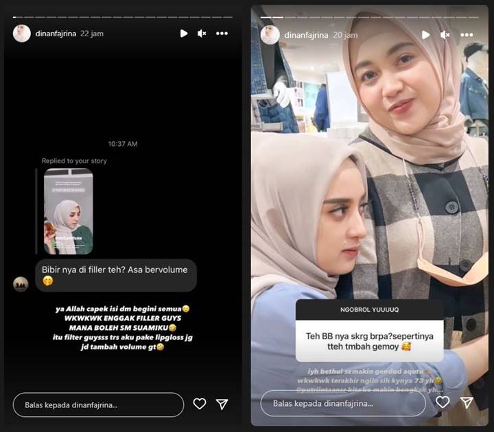 Istri Doni Salmanan Curhat Capek Kebanjiran DM Soal Bentuk Bibir