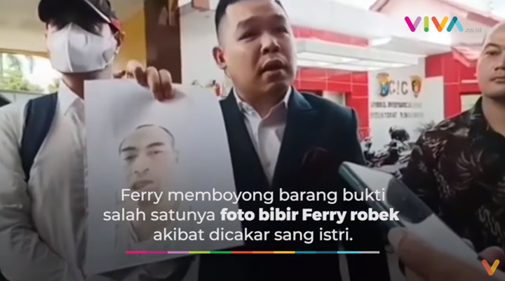 Bibir Ferry Irawan Robek Diduga Ulah Venna Melinda Sebelum Insiden di Kediri