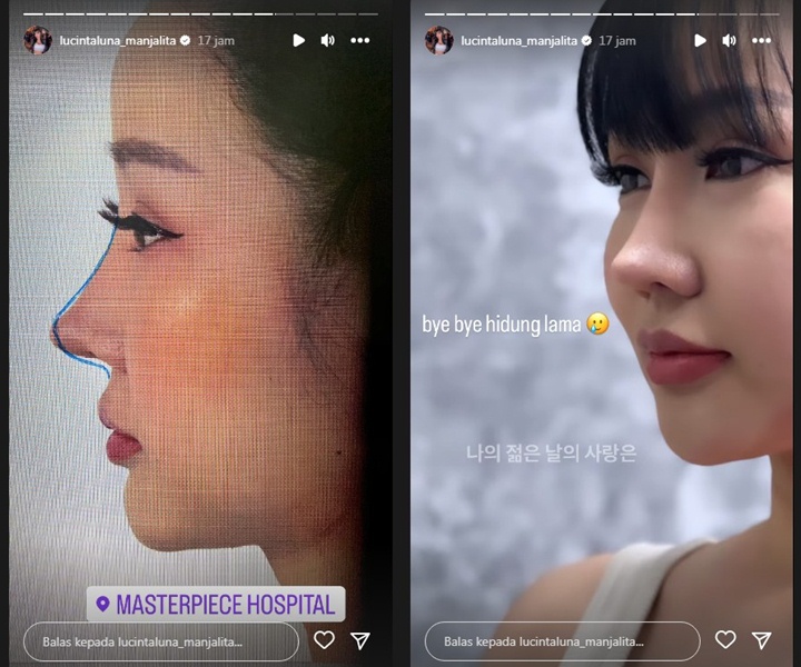 Lucinta Luna Ngaku Wajahnya Akan Dibedah Lagi Jadi Mirip Jennie BLACKPINKK
