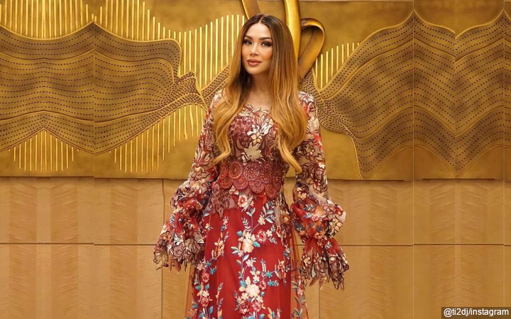 Titi DJ Perdana Pamer Hasil Operasi Anti Aging di Korea Selatan