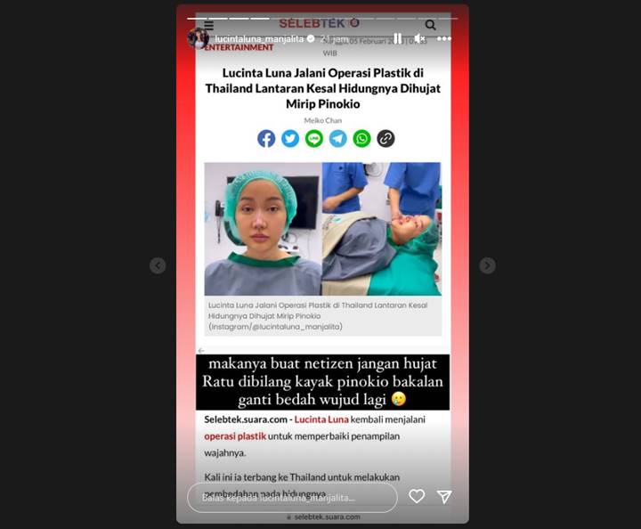 Ungkap Alasan Bedah Wujud Hidung, Lucinta Luna Wanti-wanti Tak Dihujat Lagi