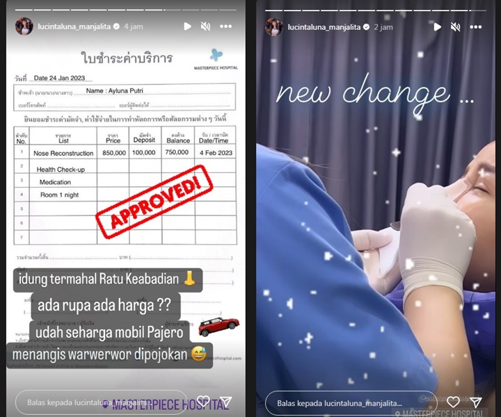 Lucinta Luna Bedah Wujud Lagi Demi Mirip Idol K-Pop, Hidung Baru Seharga Mobil Pajero Lucinta Luna Bedah Wujud Lagi Demi Mirip Idol K-Pop, Hidung Baru Seharga Mobil Pajero Lucinta Luna Bedah Wujud Lagi Demi Mirip Idol K-Pop, Hidung Baru Seharga Mobil Pajero