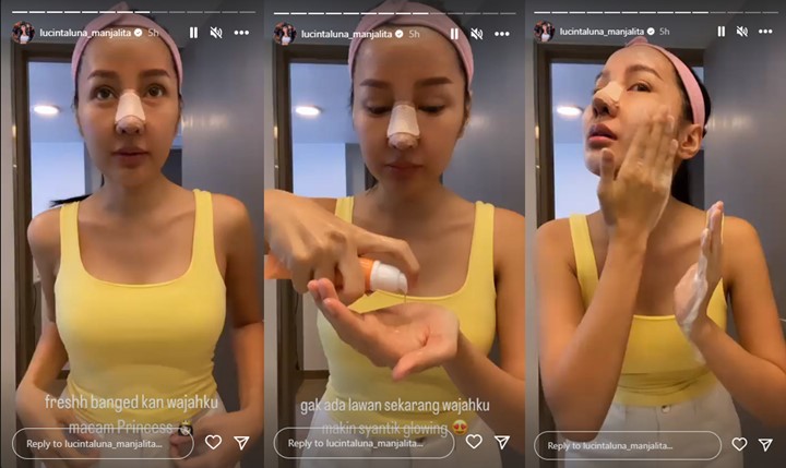 Lucinta Luna Bangga Tak Bengkak Pasca Oplas, Sebut Wajahnya Makin Sempurna Lucinta Luna Bangga Tak Bengkak Pasca Oplas, Sebut Wajahnya Makin Sempurna