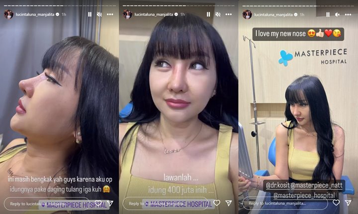 Lucinta Luna Akhirnya Spill Penampakan Hidung Baru, Dipuji Cantik Parah