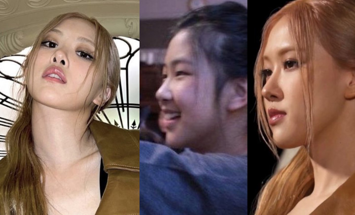 Hidung Mancung Rose BLACKPINK Jadi Pembicaraan, Dibandingkan dengan Masa Pra-Debut Hidung Mancung Rose BLACKPINK Jadi Pembicaraan, Dibandingkan dengan Masa Pra-Debut